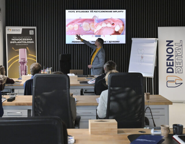 Szkolenie z&nbsp;zakresu implantoprotetyki stomatologicznej – moduł zaawansowany - galeria zdjęć